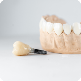 Dentist holding a set of full dentures